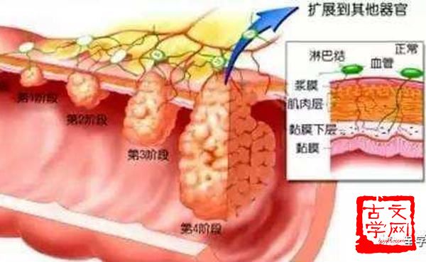 不足齿数