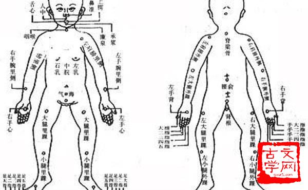 痰迷心窍