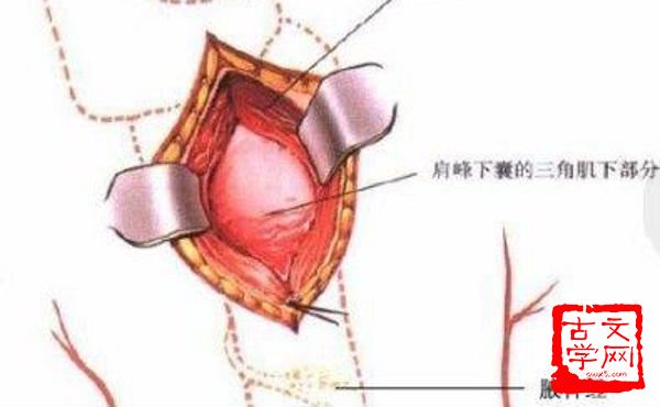 肌劈理解